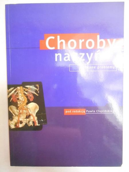 Chęciński Paweł - Choroby naczyń