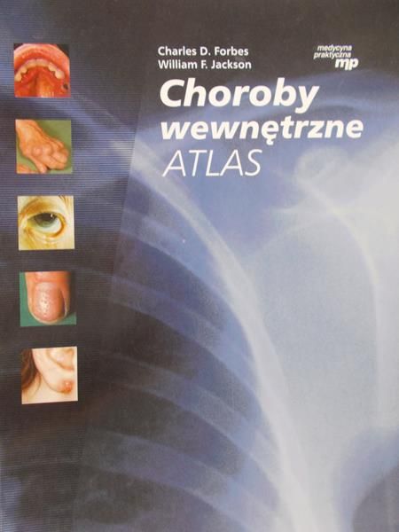 Forbes Charles D. - Choroby wewnętrzne. Atlas