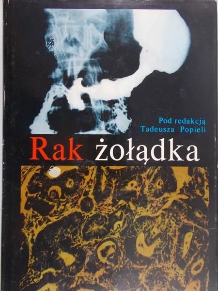 Popiela Tadeusz (red.) - Rak żołądka
