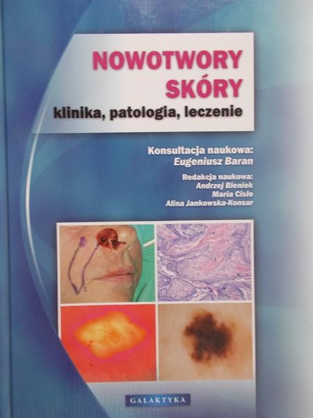 Baran Eugeniusz - Nowotwory skóry