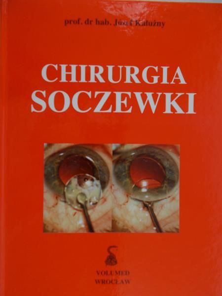 Kałużny Józef - Chirurgia soczewki