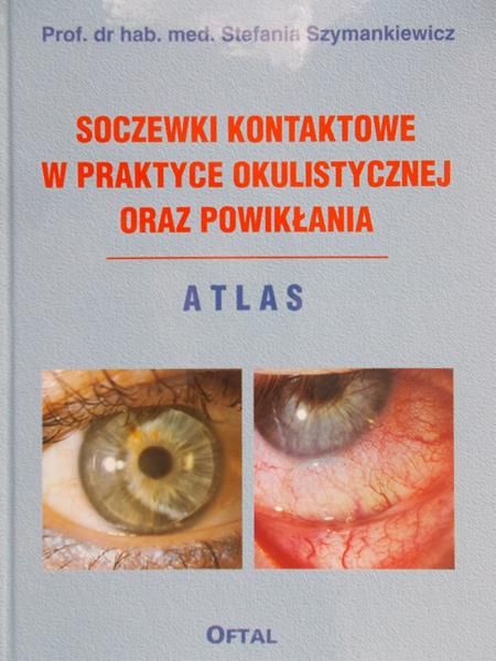Szymankiewicz Stefania - Soczewki kontaktowe w praktyce okulistycznej oraz powikłania