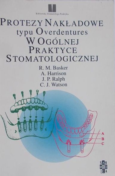 Basker R. M. - Protezy nakładowew ogólnej praktyce stomatologicznej