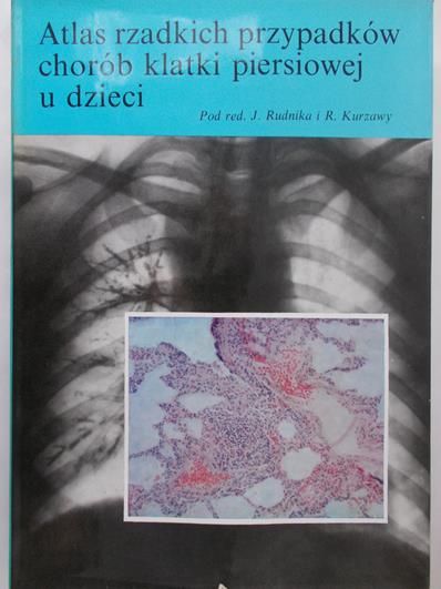 Rudnik J. (red.) - Atlas rzadkich przypadków chorób klatki piersiowej u dzieci