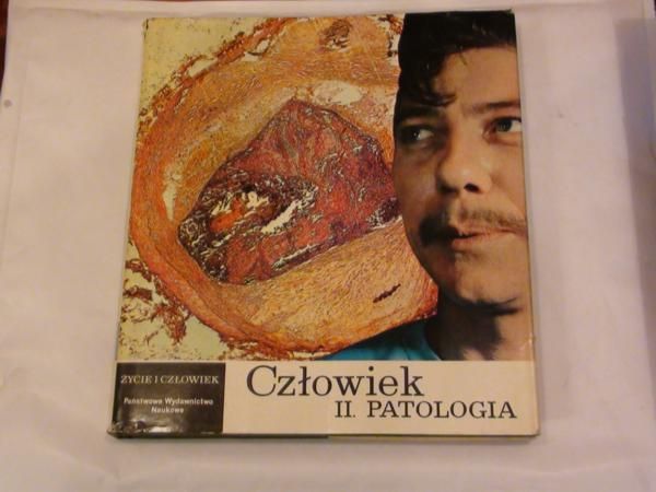Człowiek - Patologia Tom II