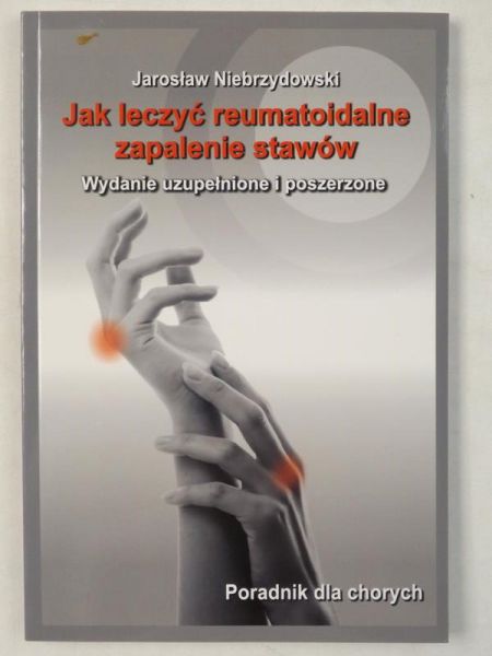Niebrzydowski Jarosław - Jak leczyć reumatoidalne zapalenie stawów