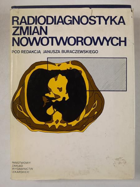 Buraczewski   Janusz  (red.) - Radiodiagnostyka zmian nowotworowych