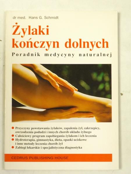 Żylaki kończyn dolnych