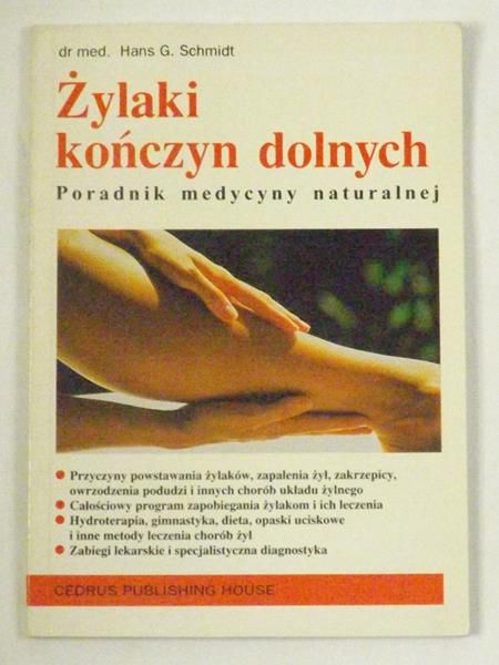 Żylaki kończyn dolnych
