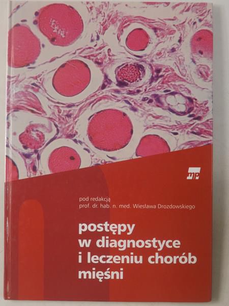 Postępy w diagnostyce i leczeniu chorób mięśni