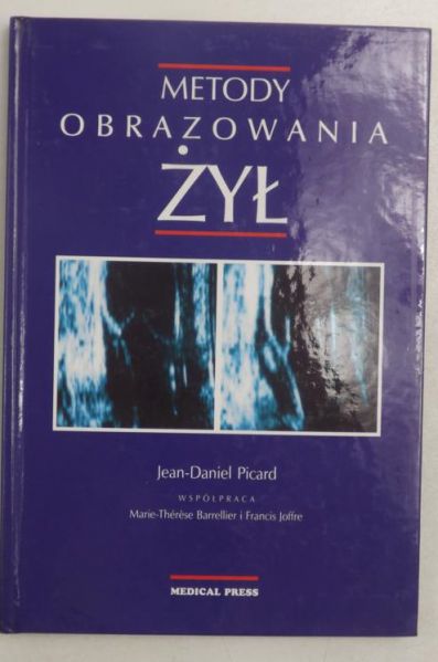 Metody obrazowania żył