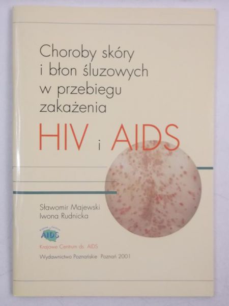 Majewski Sławomir - Choroby skóry i błon śluzowych w przebiegu zakażenia