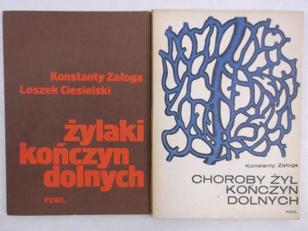 Żylaki kończyń dolnych / Choroby żył kończyn dolnych