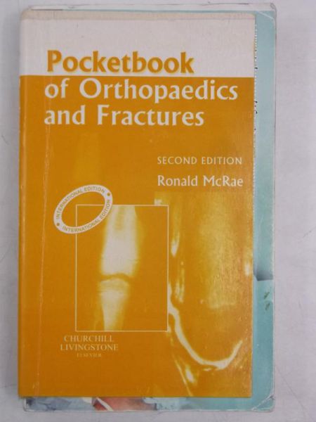 Pocketbook of Orthopaedics and Fractures
