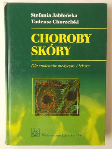 Choroby skóry