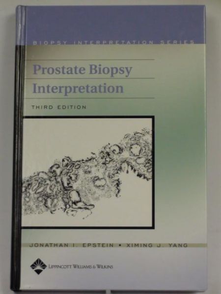 Epstein Jonathan, Yang Ximing - Prostate Biopsy Interpretation