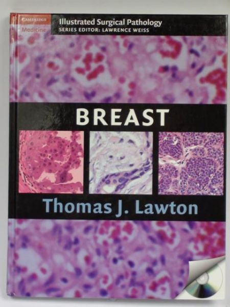 Breast