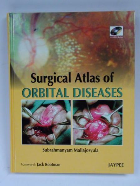 Surgical Atlas of Orbital Diseases