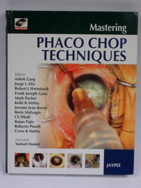 Mastering Phaco Chop Technigues