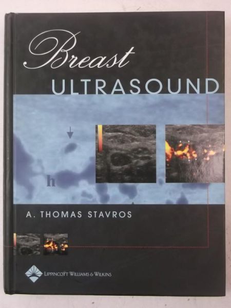 Breast Ultrasound
