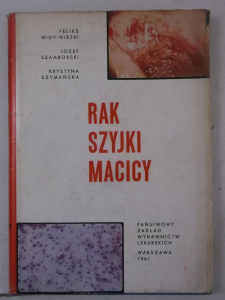 Rak szyjki macicy