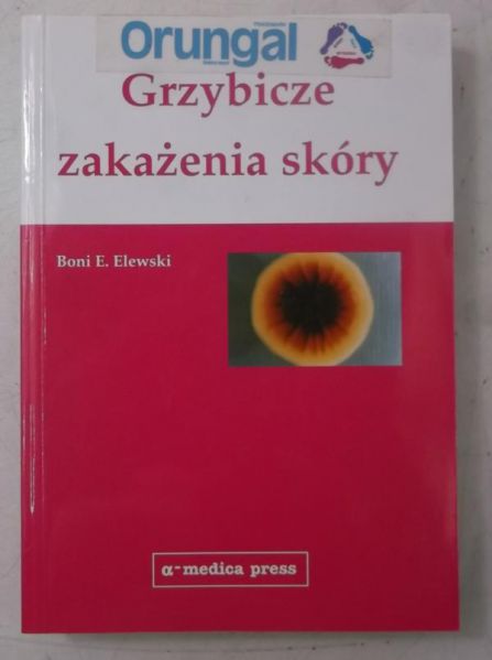 lewski  . - Grzybicze zakażenia skóry