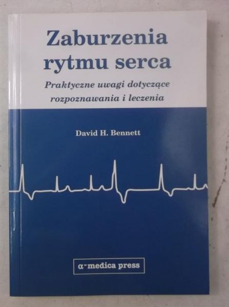Zaburzenia rytmu serca