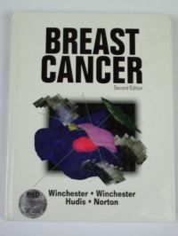 Breast Cancer