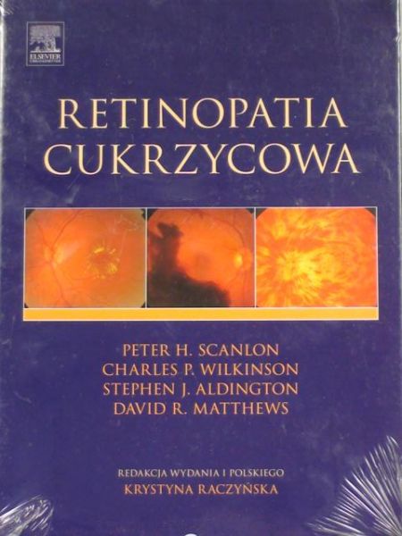 Retinopatia cukrzycowa
