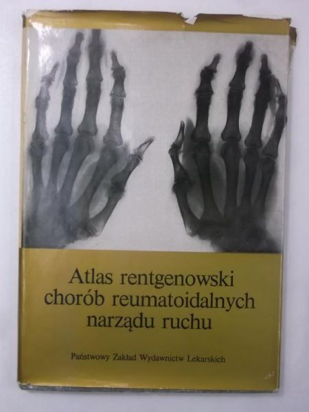 Atlas rentgenowski chorób reumatoidalnych narządu ruchu