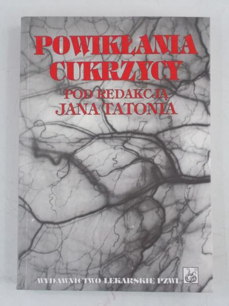 Powikłania cukrzycy