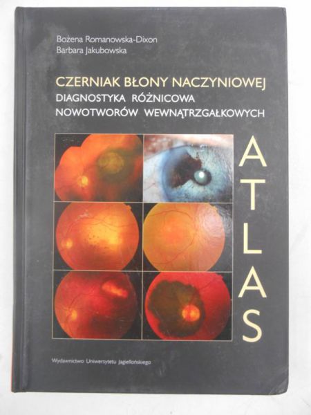 Romanowska-Dixon Bożena - Czerniak błony naczyniowej