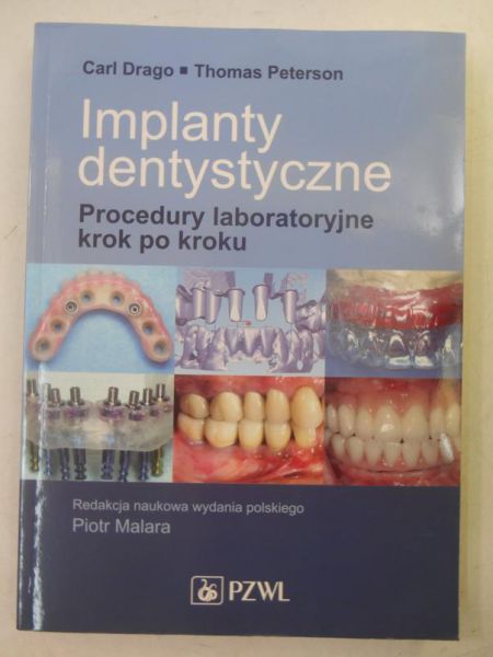 Implanty dentystyczne