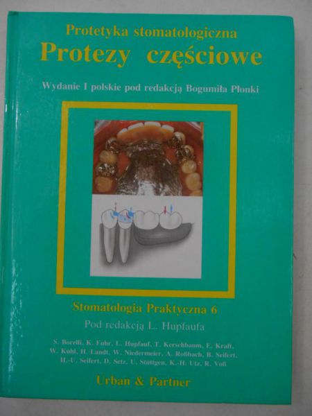 Protezy częściowe
