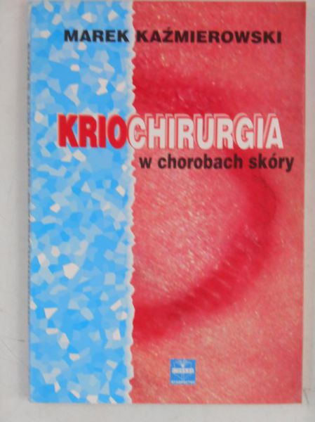 Kriochirurgia w chorobach skóry