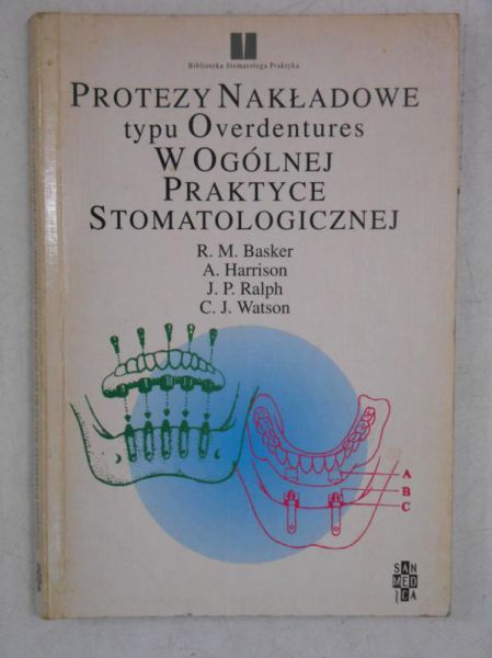 Basker R.M. - Protezy nakładowe typu Overdentures w ogólnej praktyce stomatologicznej
