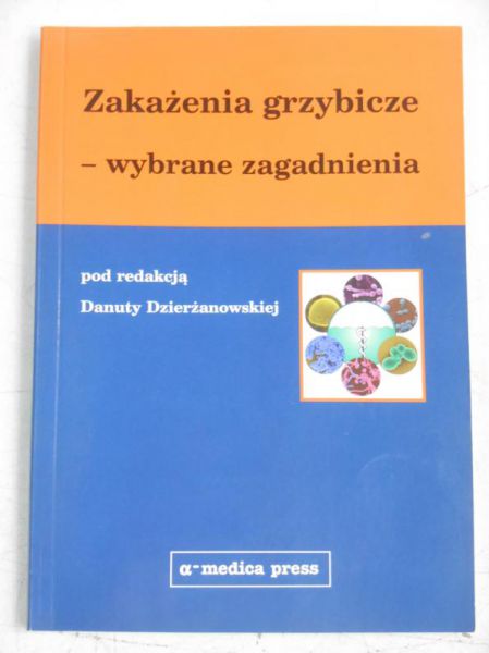Zakażenia grzybicze-wybrane zagadnienia