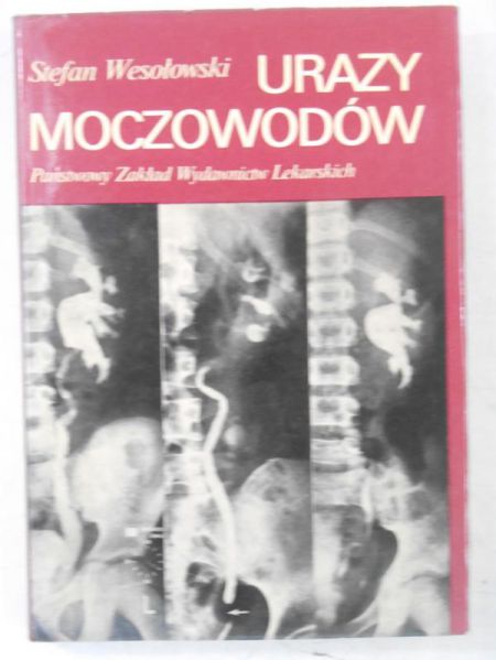 Urazy moczowodów