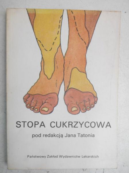 Stopa cukrzycowa