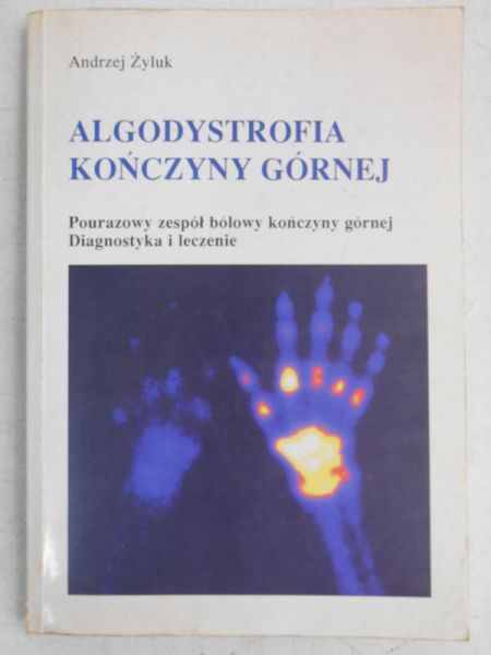 Algodystrofia kończyny górnej