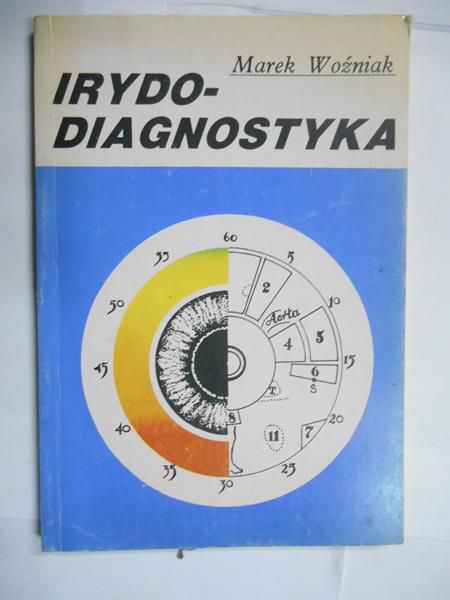 Irydodiagnostyka