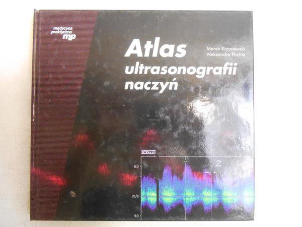 Atlas ultrasonografii naczyń