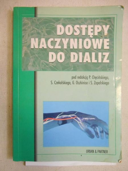 Dostępy naczyniowe do dializ