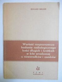 Wartość rozpoznawcza badania radiologicznego kości długich i krótkich w kile wrodzonej u noworodków i osesków