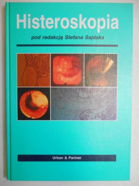 Histeroskopia