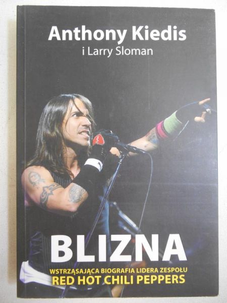 Blizna