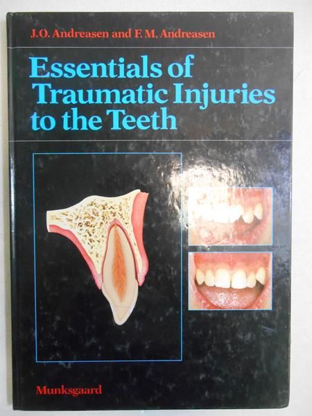 Essentials of Traumatic Injuries to the Teeth