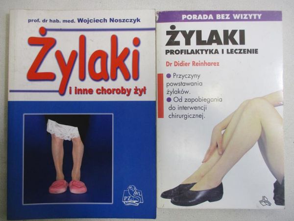 Żylaki. Profilaktyka i leczenie  Żylaki i inne choroby żył