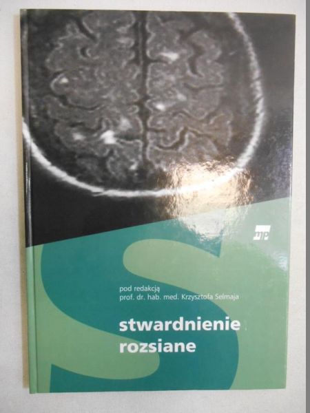Stwardnienie rozsiane