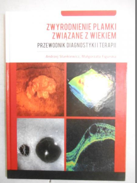 Zwyrodnienie plamki związane z wiekiem